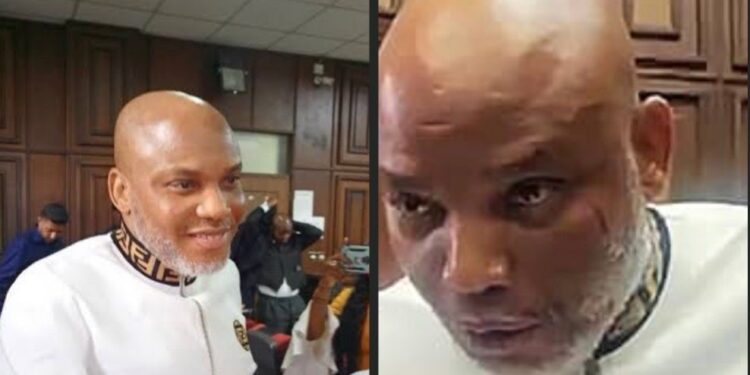Nnamdi Kanu Has Case To Answer, Says Court, Rejects bid for transfer to Nat'l hospital