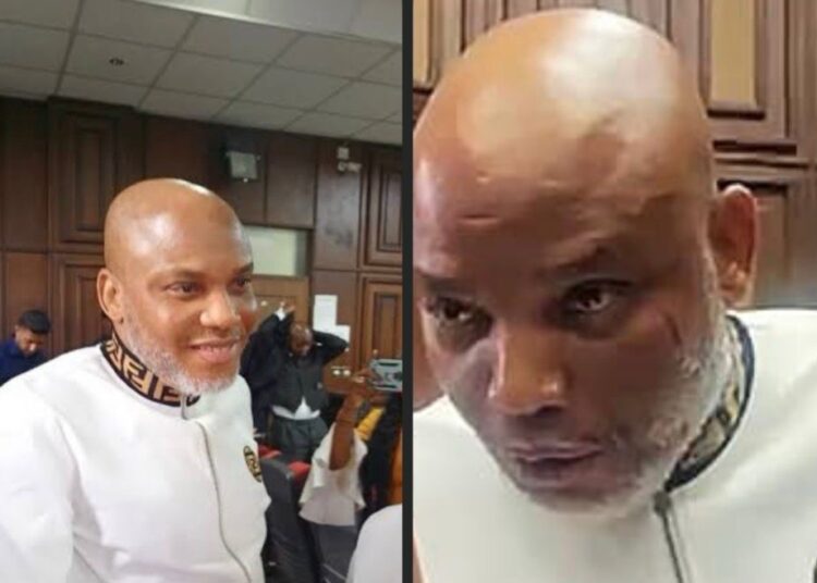 JUST IN: Nnamdi Kanu Sacks his Lawyers, Says he is ready to defend himself 1 Nnamdi Kanu Has Case To Answer, Says Court, Rejects bid for transfer to Nat'l hospital
