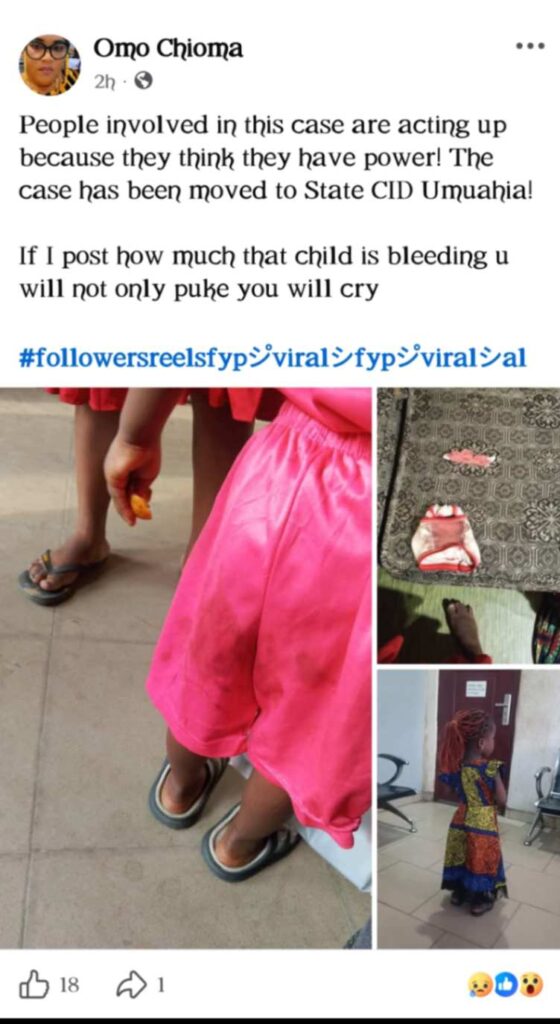 Outrage in Aba as School Security Guard Defiles 3-Year-Old Nursery Pupil