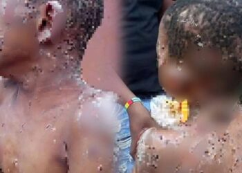 CLO Condemns Brutal Abuse of Anambra Child, Demands Justice for Master Chiziterem
