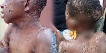 CLO Condemns Brutal Abuse of Anambra Child, Demands Justice for Master Chiziterem