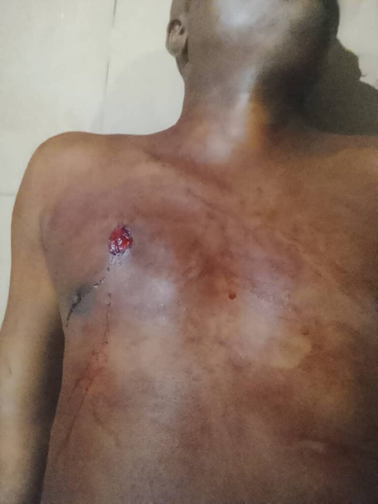 Aba Woman Allegedly Stabs Husband to Death Eight Months After Wedding Over Phone Dispute