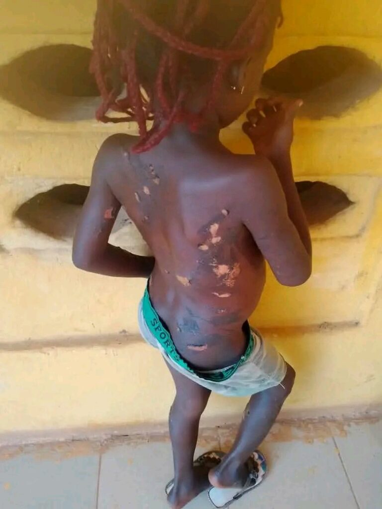 Mother arrested in Anambra for using hot knife on 7-year-old daughter