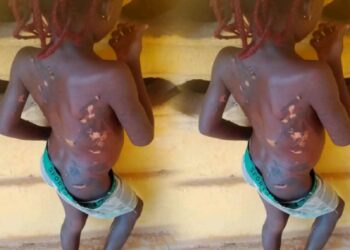 Mother arrested in Anambra for using hot knife on 7-year-old daughter
