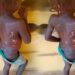 Mother arrested in Anambra for using hot knife on 7-year-old daughter
